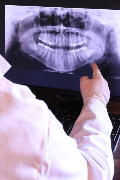 Best Emergency Treatment for Dental Infections or Abscesses in Verde Village, AZ